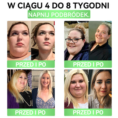 🧡🧡🧡ANGELTRAP® Moringa × Berberyna × AMPK 10-w-1 Wsparcie metaboliczne, plaster z nanotechnologią mikroigłową 🇵🇱(Wystarczy raz dziennie, widoczne efekty w 7 dni) ✅ Na otyłość, wiotką skórę, cukrzycę, bezdech senny, problemy ze stawami i wiele innych