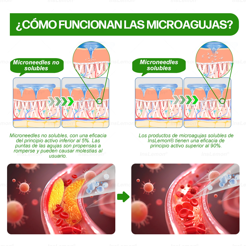 𝐈𝐧𝐬𝐋𝐞𝐦𝐨𝐧® 𝗠𝗼𝗿𝗶𝗻𝗴𝗮 × 𝗕𝗲𝗿𝗯𝗲𝗿𝗶𝗻𝗮 × 𝗔𝗠𝗣𝗞 𝟭𝟬-𝗶𝗻-𝟭 𝗣𝗮𝗿𝗰𝗵𝗲 𝗠𝗲𝘁𝗮𝗯𝗼𝗹𝗶𝗰𝗼 𝗱𝗲 𝗡𝗮𝗻𝗼 𝗠𝗶𝗰𝗿𝗼𝗮𝗴𝗵𝗮 (🇪🇸 Solo una vez al día, cambios visibles en 7 días) ✅ Para sobrepeso, diabetes, apnea del sueño, problemas articulares y más.