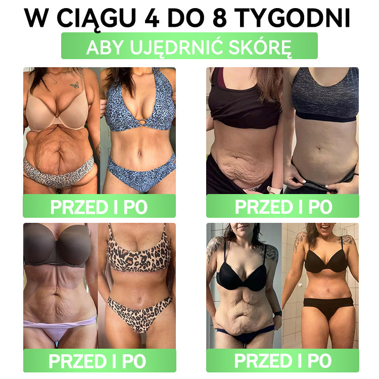 🧡🧡🧡ANGELTRAP® Moringa × Berberyna × AMPK 10-w-1 Wsparcie metaboliczne, plaster z nanotechnologią mikroigłową 🇵🇱(Wystarczy raz dziennie, widoczne efekty w 7 dni) ✅ Na otyłość, wiotką skórę, cukrzycę, bezdech senny, problemy ze stawami i wiele innych