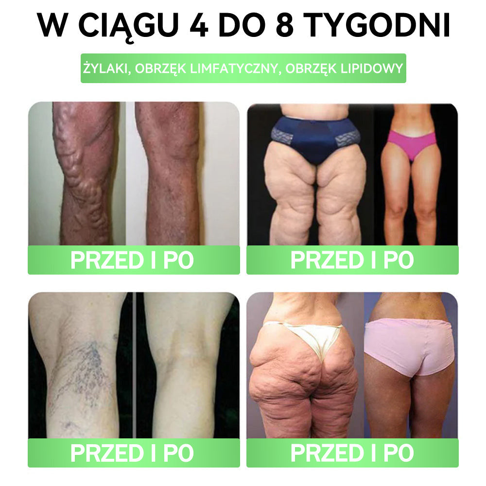 🧡🧡🧡ANGELTRAP® Moringa × Berberyna × AMPK 10-w-1 Wsparcie metaboliczne, plaster z nanotechnologią mikroigłową 🇵🇱(Wystarczy raz dziennie, widoczne efekty w 7 dni) ✅ Na otyłość, wiotką skórę, cukrzycę, bezdech senny, problemy ze stawami i wiele innych