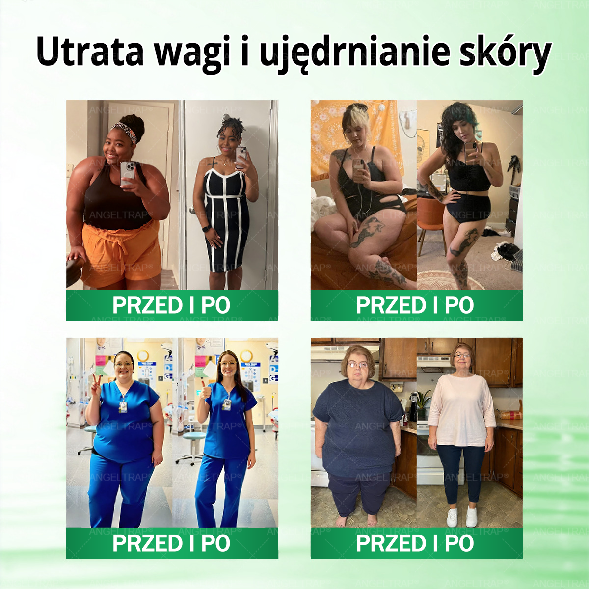 🧡🧡🧡ANGELTRAP® Moringa × Berberyna × AMPK 10-w-1 Wsparcie metaboliczne, plaster z nanotechnologią mikroigłową 🇵🇱(Wystarczy raz dziennie, widoczne efekty w 7 dni) ✅ Na otyłość, wiotką skórę, cukrzycę, bezdech senny, problemy ze stawami i wiele innych