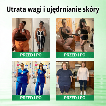 🧡🧡🧡ANGELTRAP® Moringa × Berberyna × AMPK 10-w-1 Wsparcie metaboliczne, plaster z nanotechnologią mikroigłową 🇵🇱(Wystarczy raz dziennie, widoczne efekty w 7 dni) ✅ Na otyłość, wiotką skórę, cukrzycę, bezdech senny, problemy ze stawami i wiele innych
